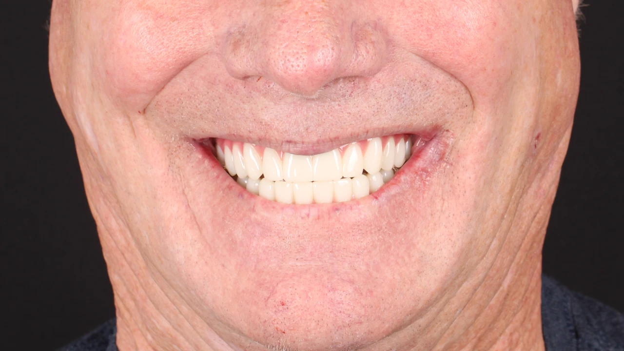 After Image