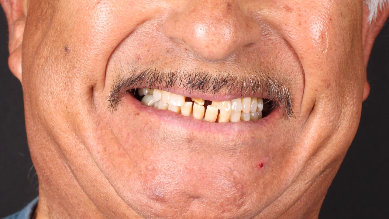 Before Image