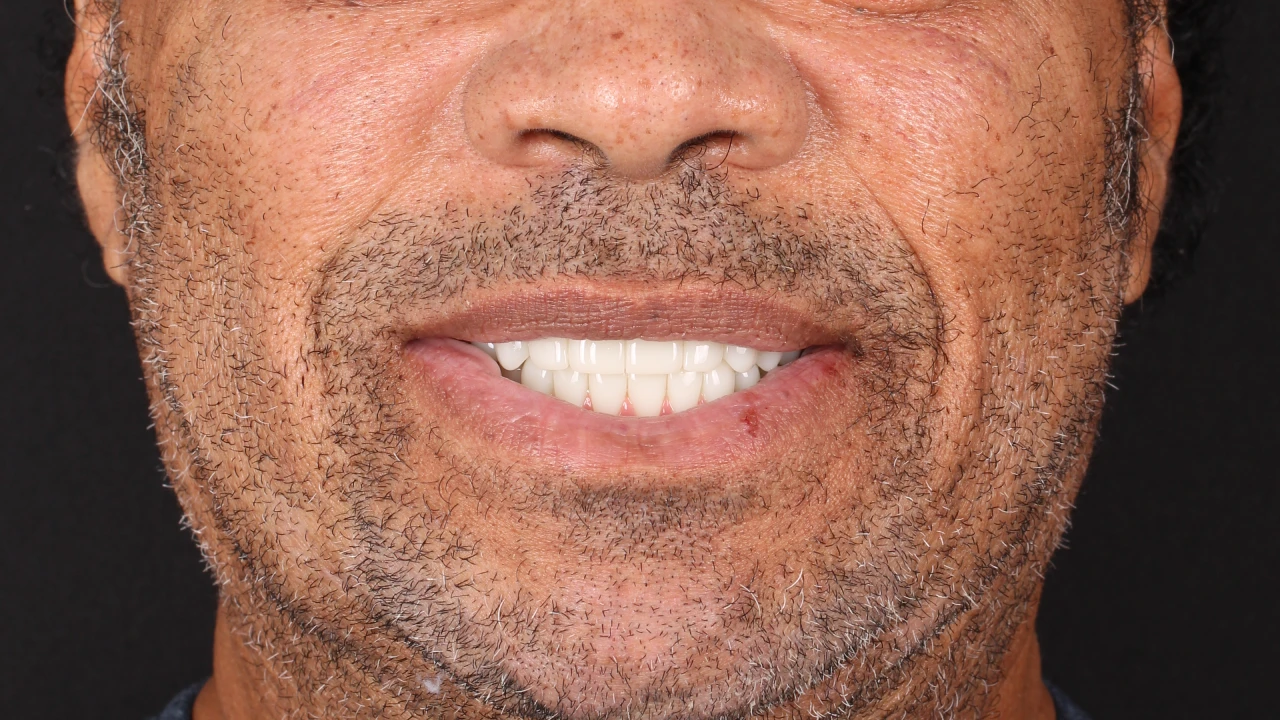 After Image