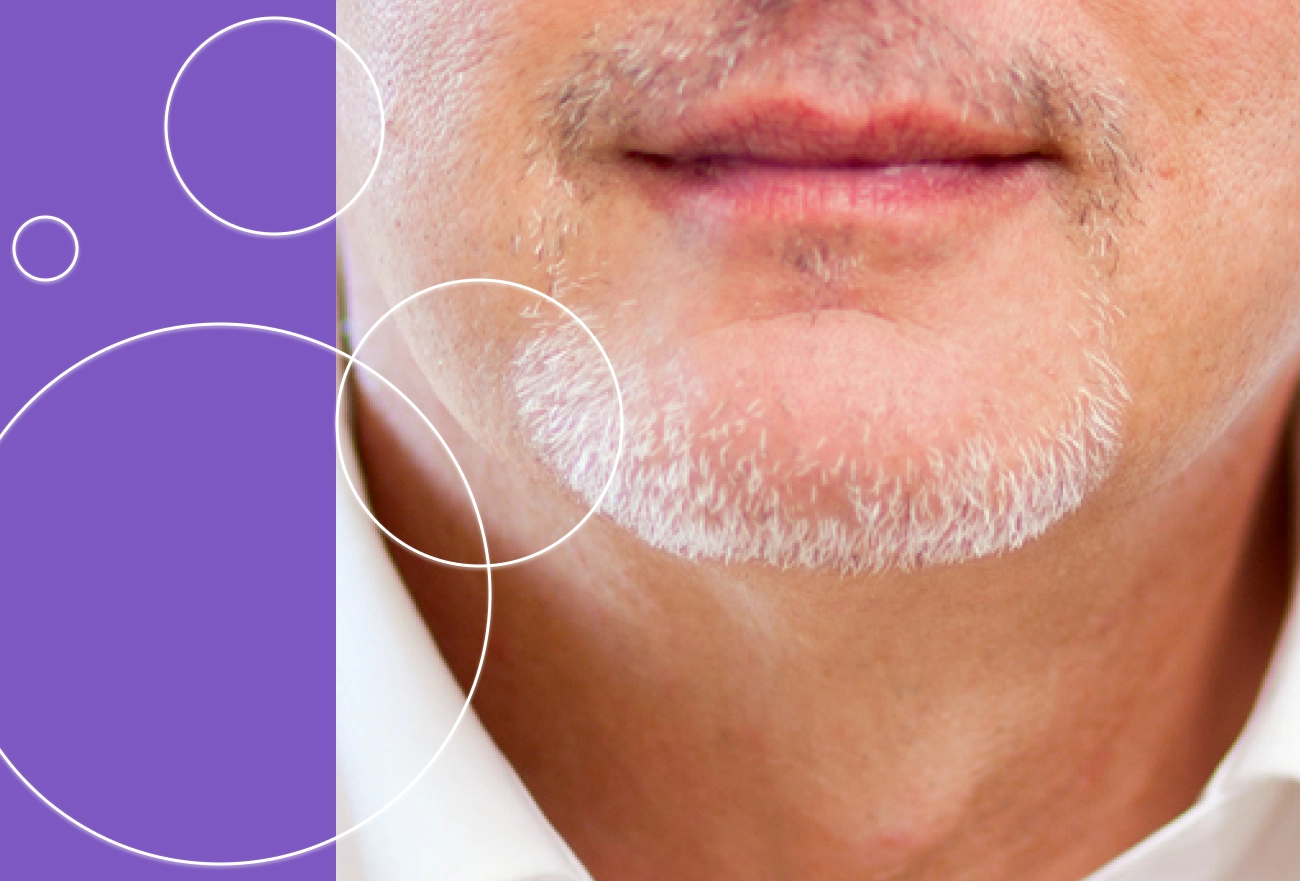 Man with gray beard with white circles marking facial treatment areas on split purple and skin background