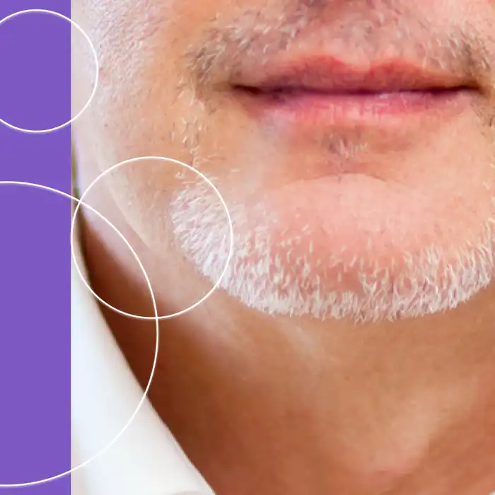 What is a Gleason Score?