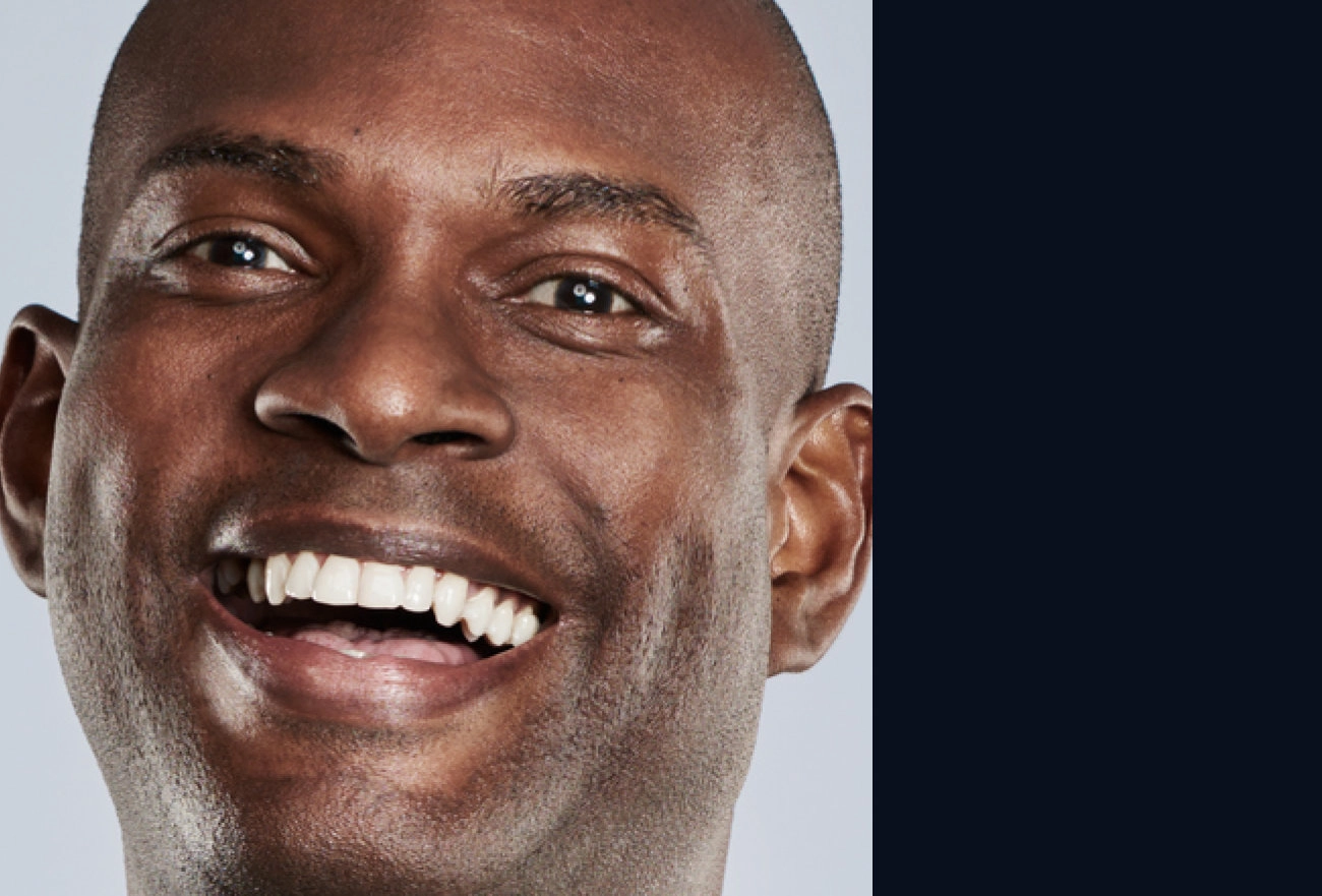 Man with bald head smiling broadly displaying white teeth against split light and dark background