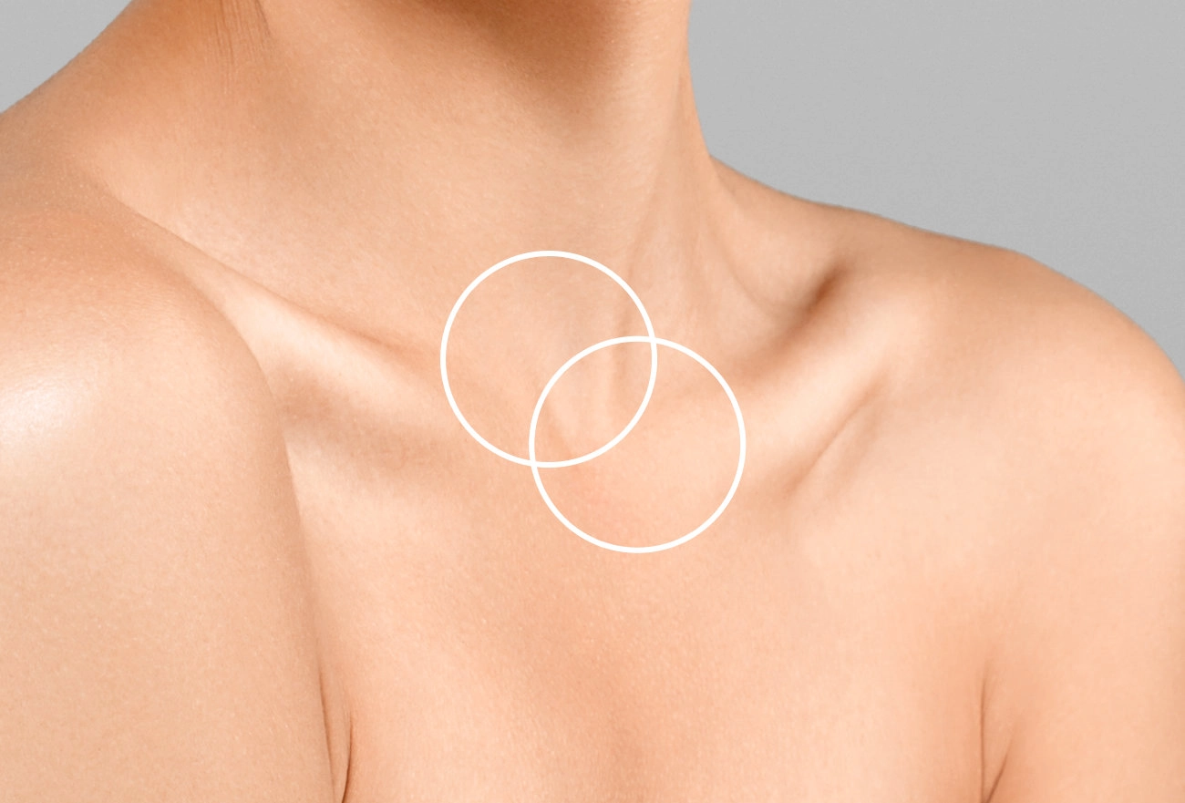 Male chest with overlapping white circles marking treatment area for body contouring procedure