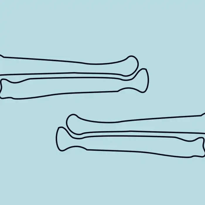 Full Body MRI for Multiple Myeloma