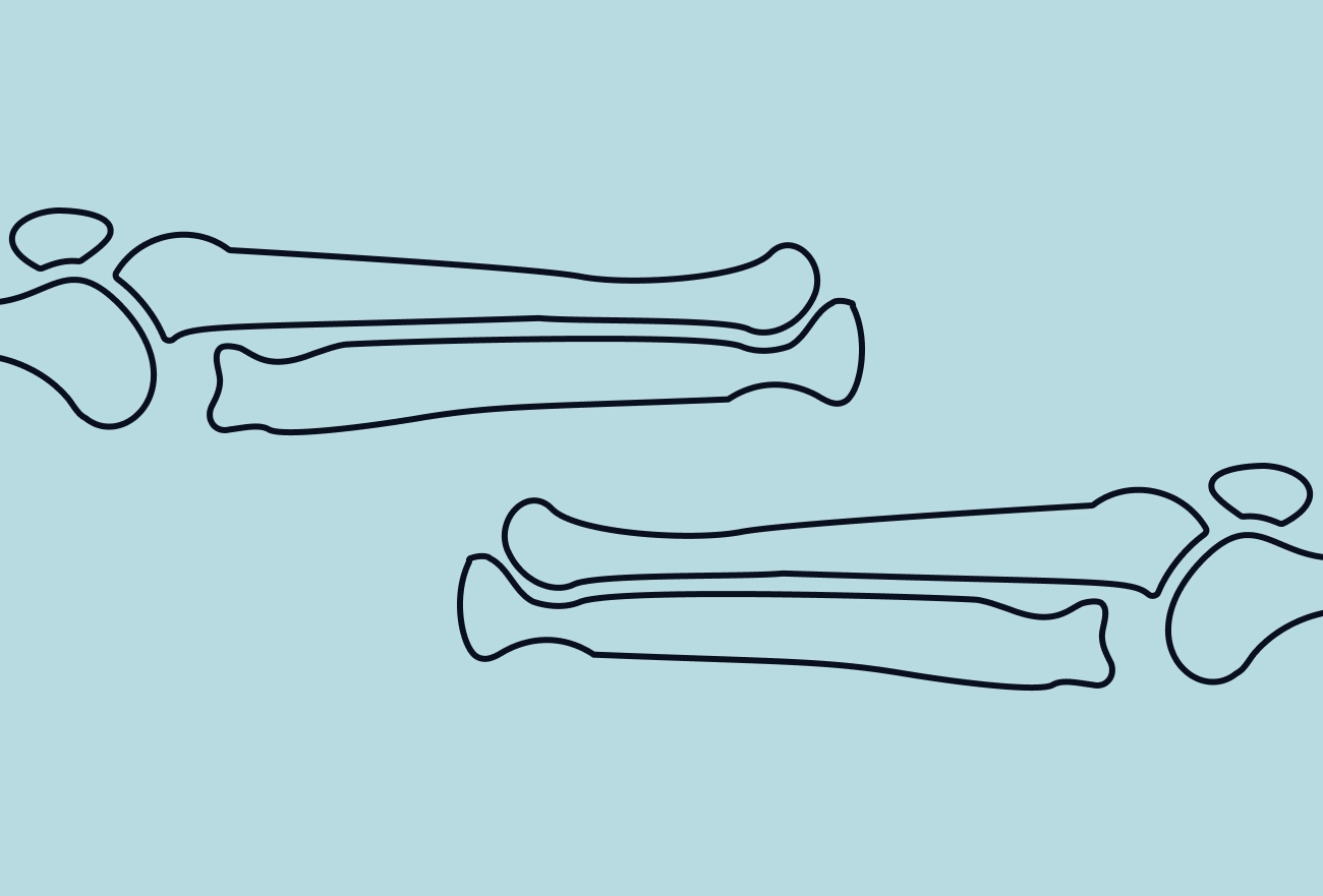Anatomical line drawing showing arm and leg skeleton bones on light blue background