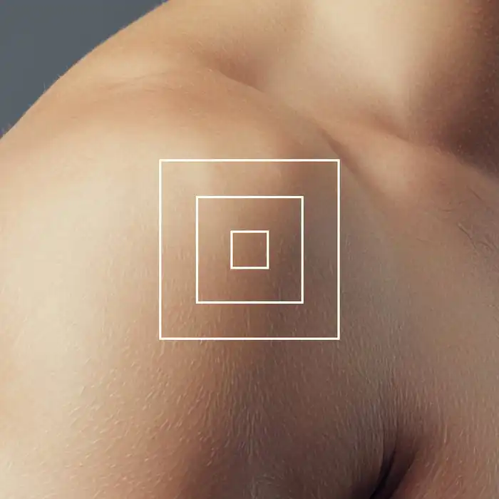 Lyme Disease Prophylaxis: Does it Work?