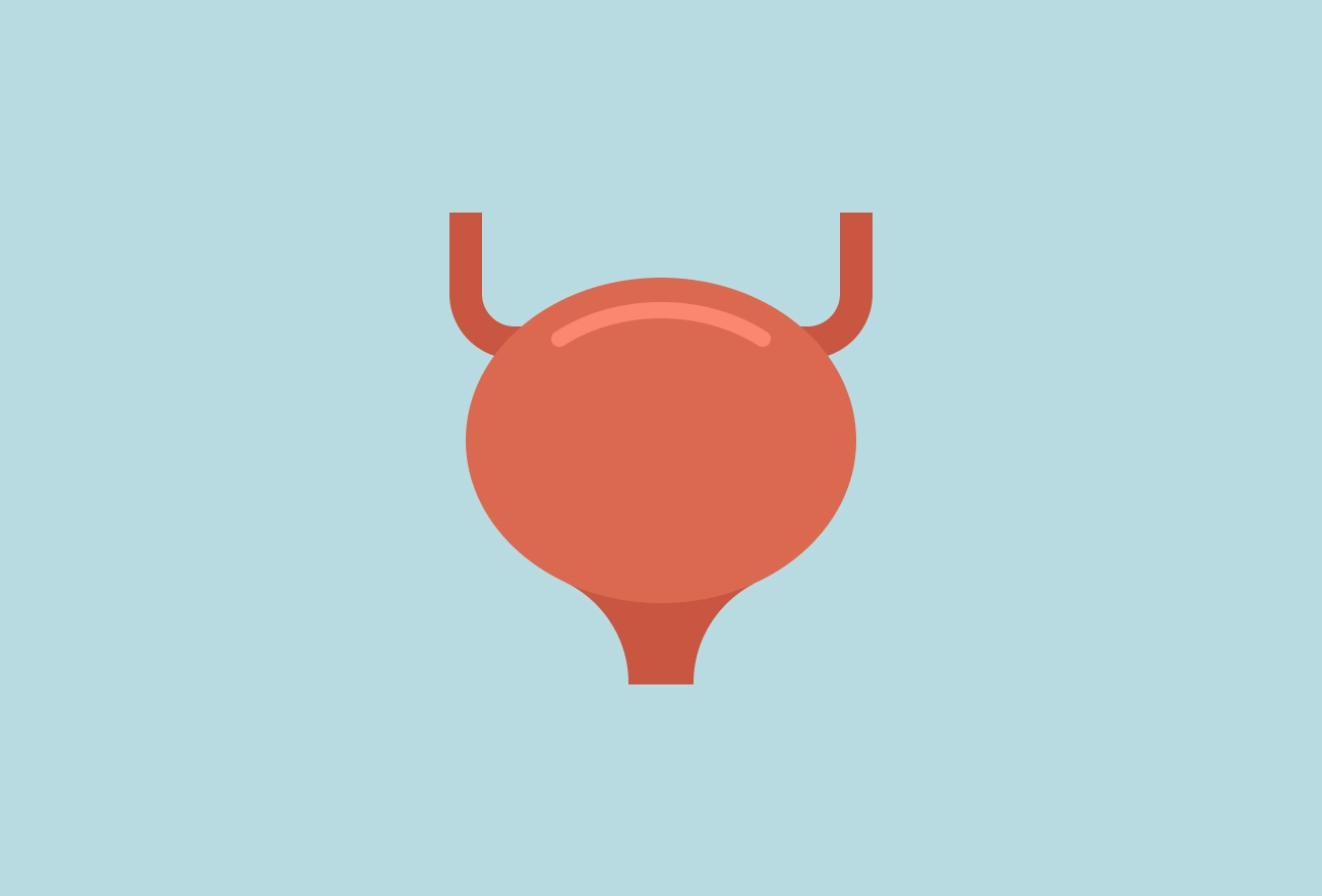 Red bladder icon with ureteral tubes on light blue background, simplified medical illustration