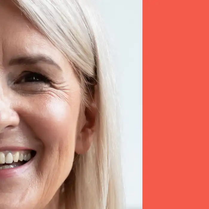 Polycystic Ovaries: Treatment