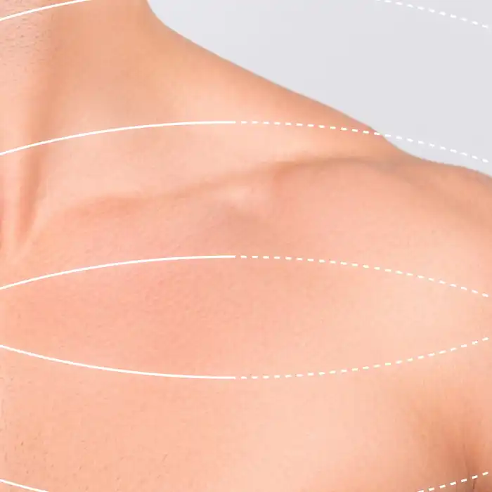 Lung Cancer: Basic Facts and Figures