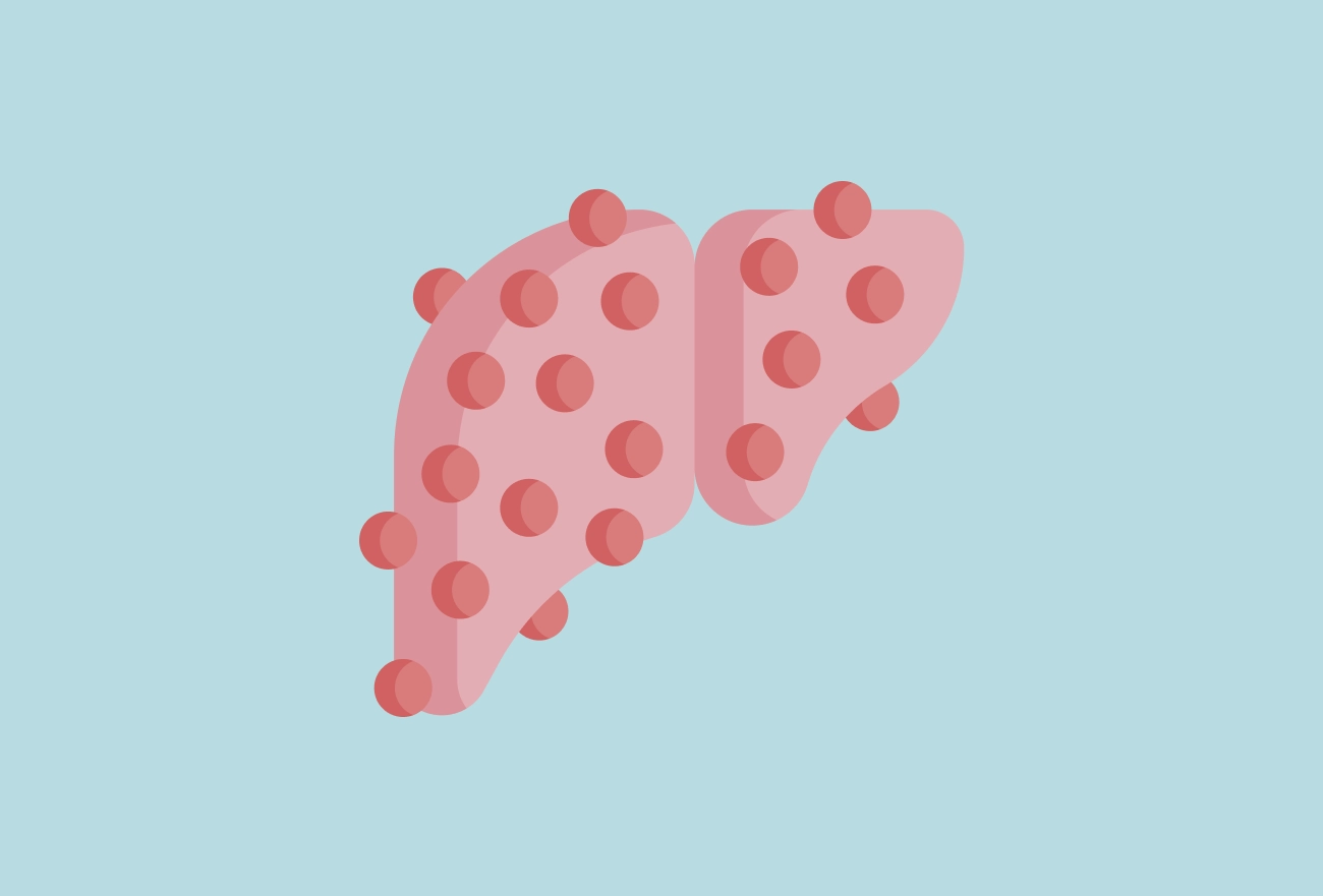 Pink liver illustration with red spots against a light blue background
