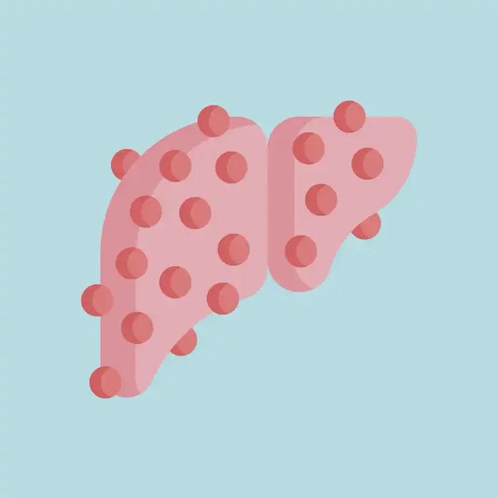 Cirrhosis: is Reversal Possible?