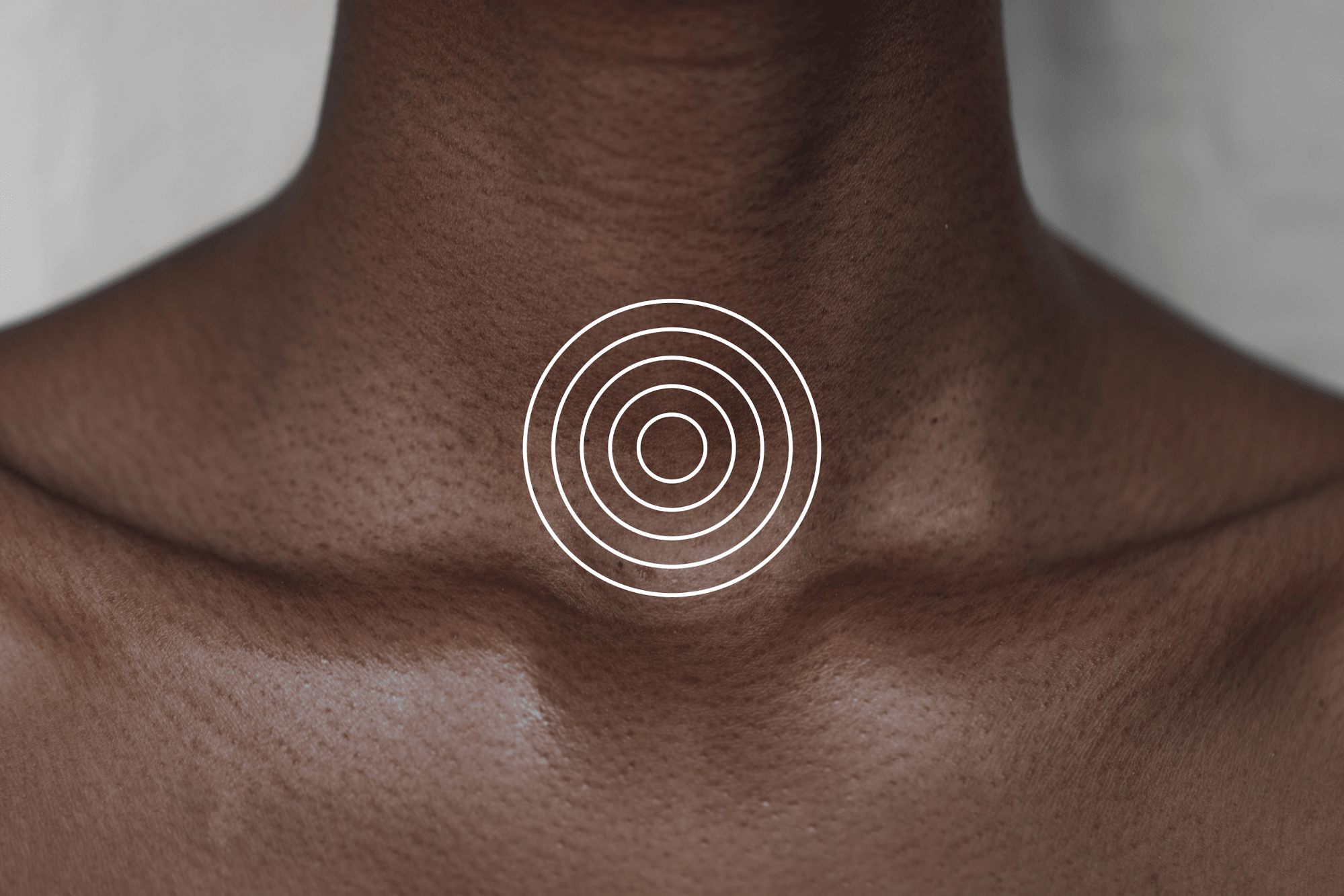 Picture of a mans torso with white circles on the neck showing where MRI scan indicates a problem