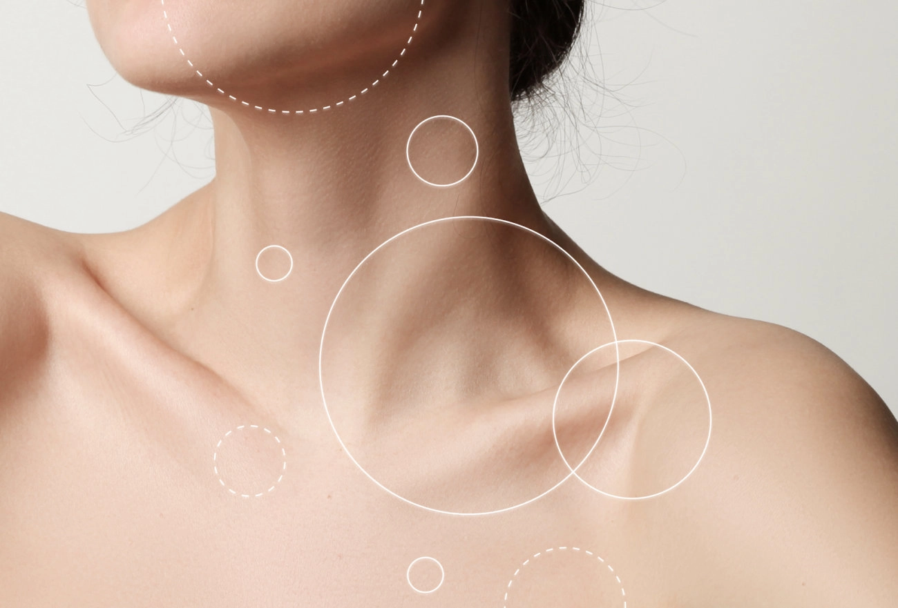 Picture of woman's upper body with white circles indicating were possible cancer cells are located