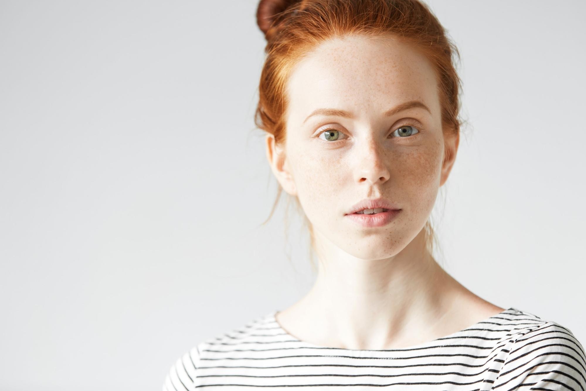 Woman with red hair in top bun and freckles wearing striped shirt, looking at camera