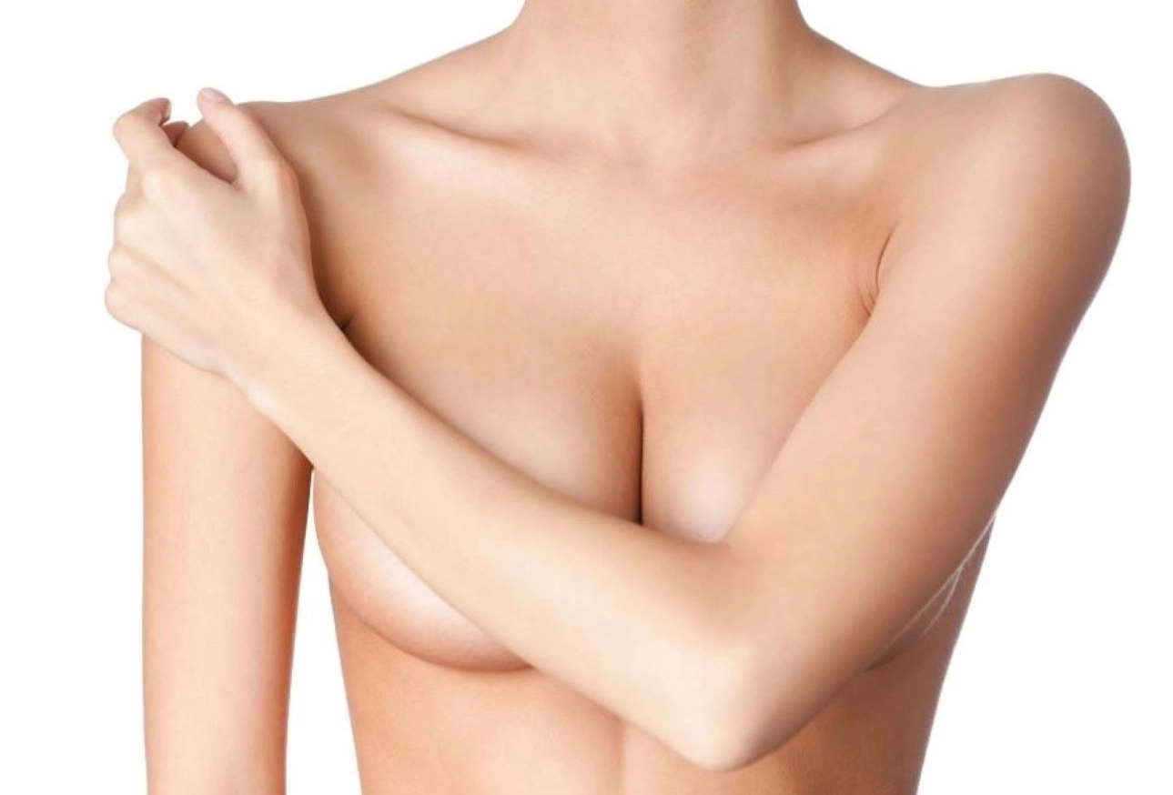 Medical illustration of female breast anatomy shown in frontal view against white background