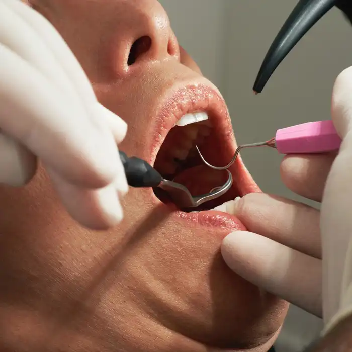 Oral Cancer Screening: Why Early Detection Can Make All the Difference