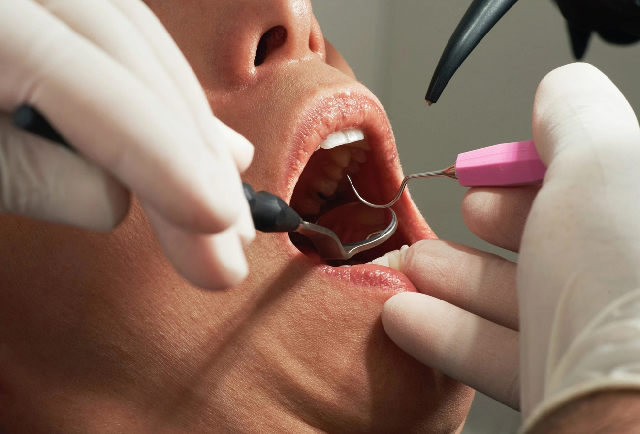 Dentist examining patient's teeth and gums with dental instruments during oral exam