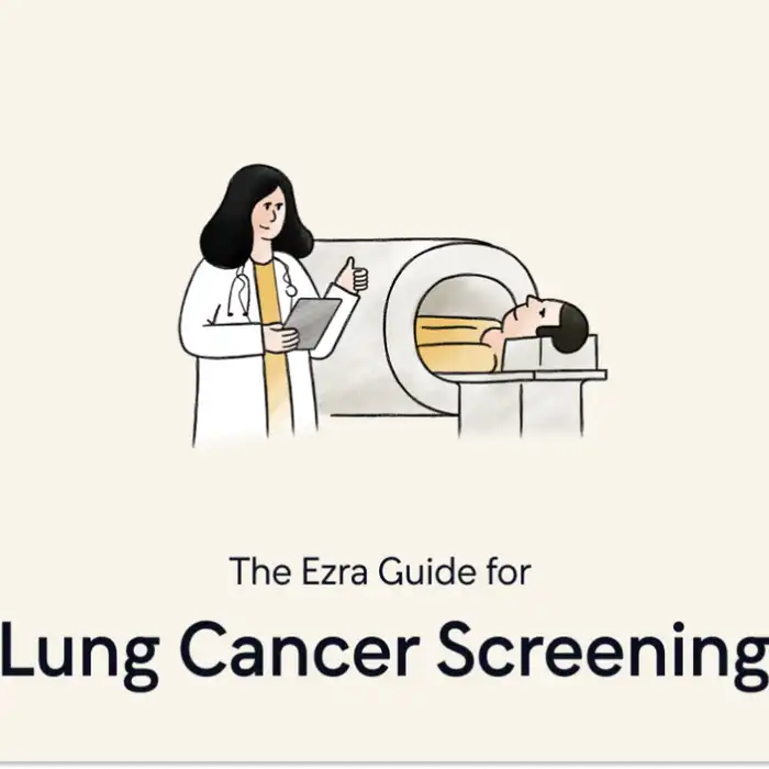 The Ezra Guide for Lung Cancer Screening