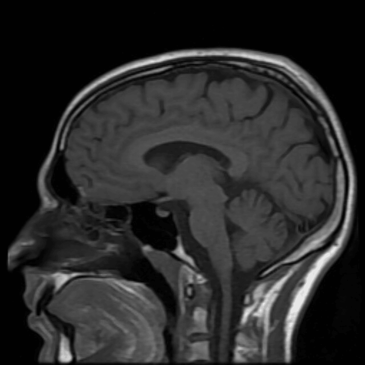 What Can a Brain Scan Reveal About Your Health?