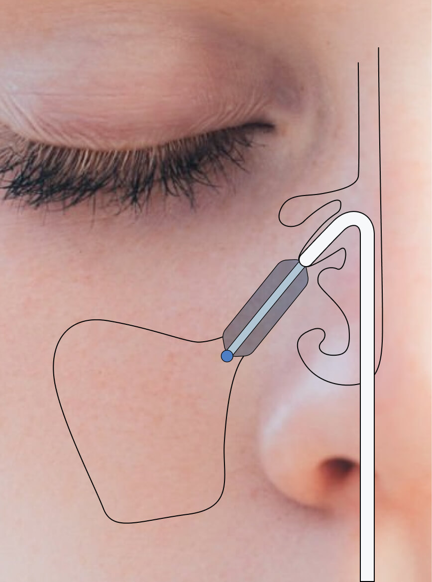device illustration