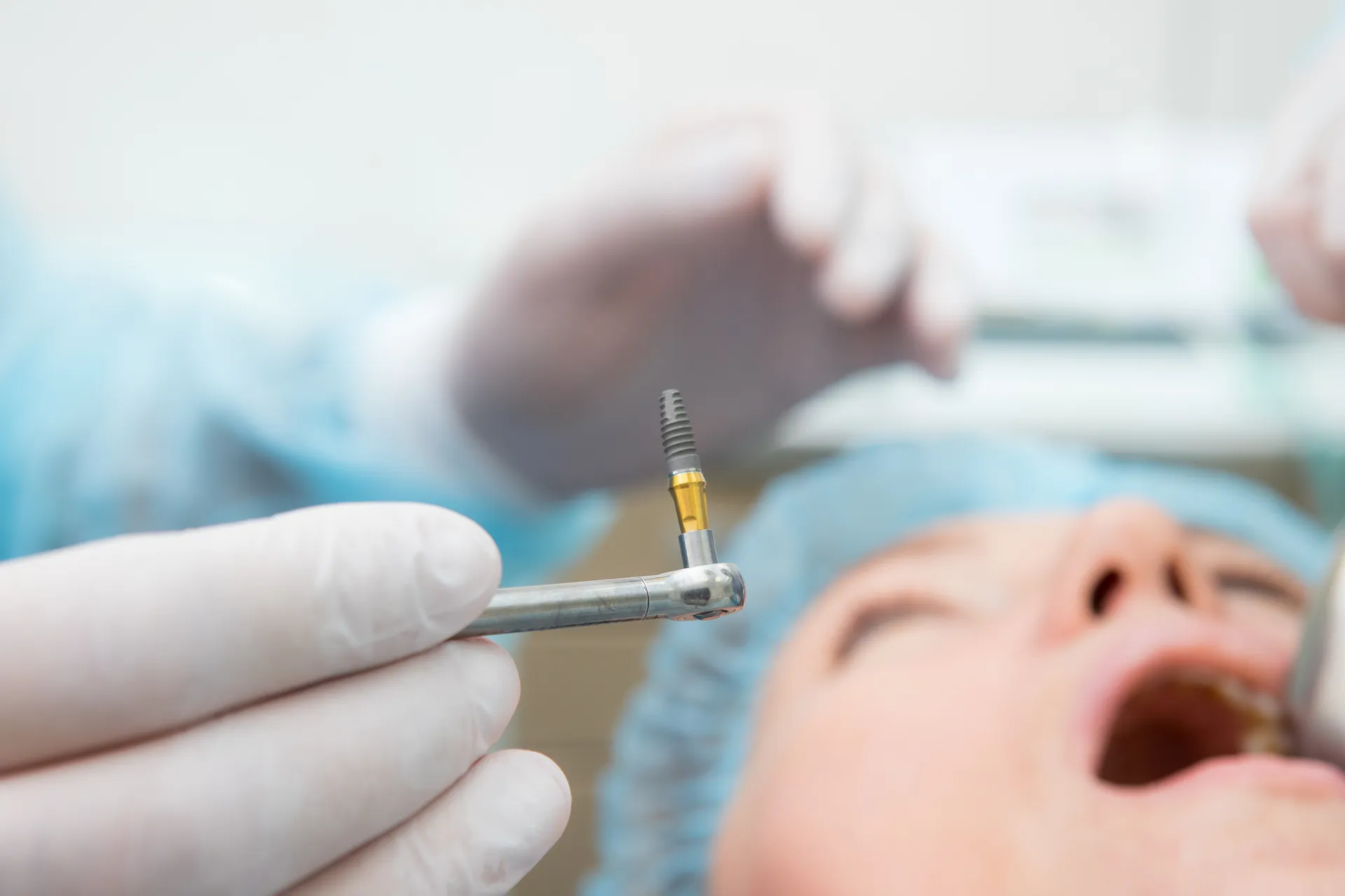 Dentist holding a dental implant tool near a patient's open mouth during a dental procedure.