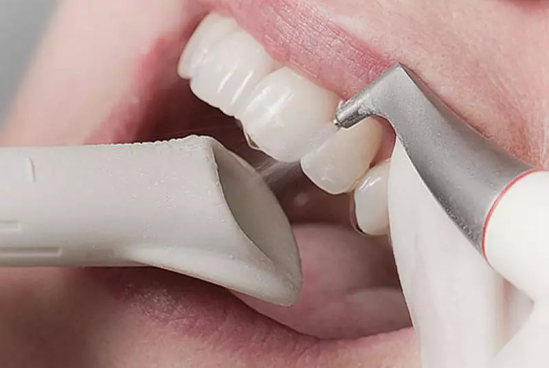 Close-up of dental air polishing tool cleaning teeth with water spray near gums.