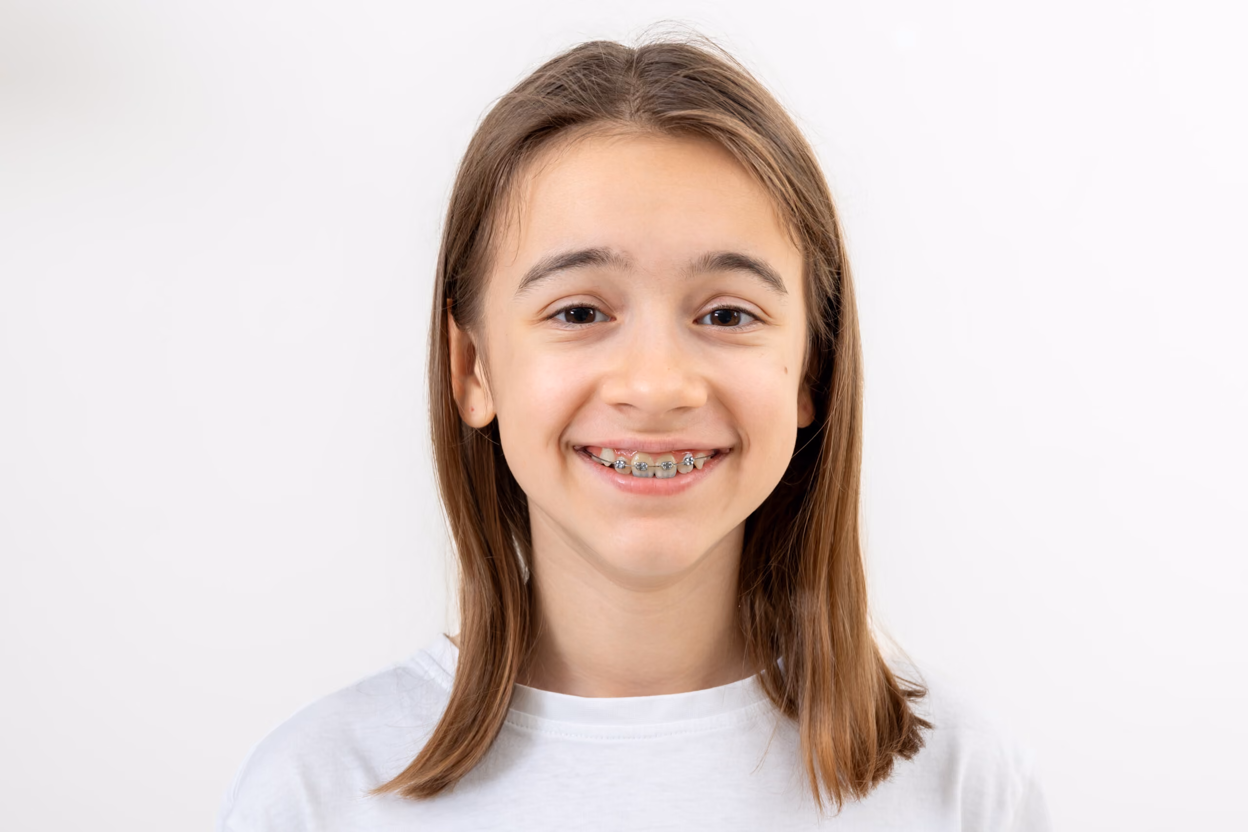 Smiling young girl with straight brown hair wearing braces and a white shirt against a white background.