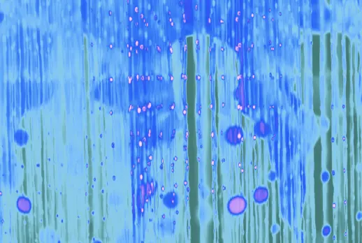 Blurry silhouettes behind a blue turquoise background.