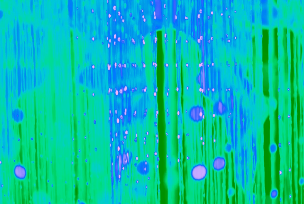 Three figures' silhouettes are visible in an abstract photo with overlapping shades of green, pink, and green, as a metaphor for the perimeter that is built with Sekoia self-hosted.