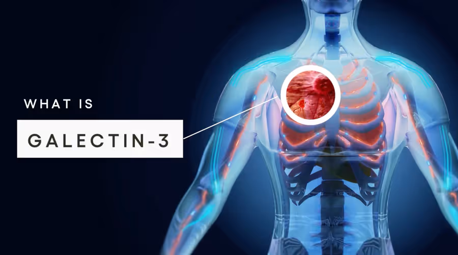 Medical illustration of a translucent human upper torso showing ribs and heart with a zoomed-in red circular area highlighting Galectin-3 protein location.