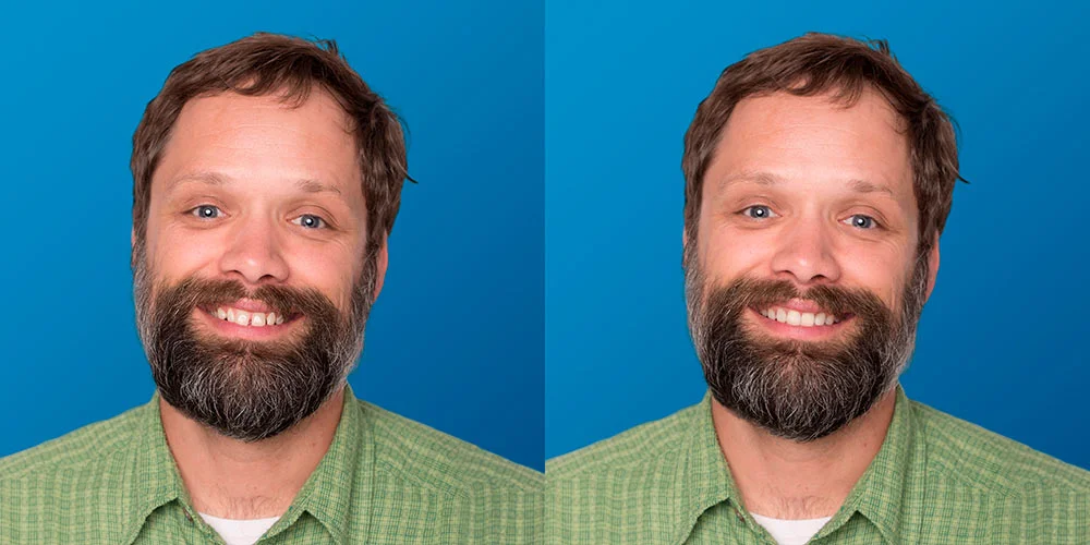 Before and After picture of a  man with a beard and a green shirt.