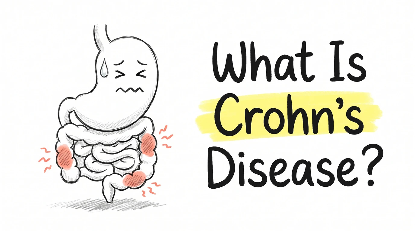 A cartoon stomach character with scrunched eyes and a sweat drop, coral inflamed patches scattered along its intestinal coil with normal stretches in between. Thumbnail for the Know Your Gut article What Is Crohn's Disease?