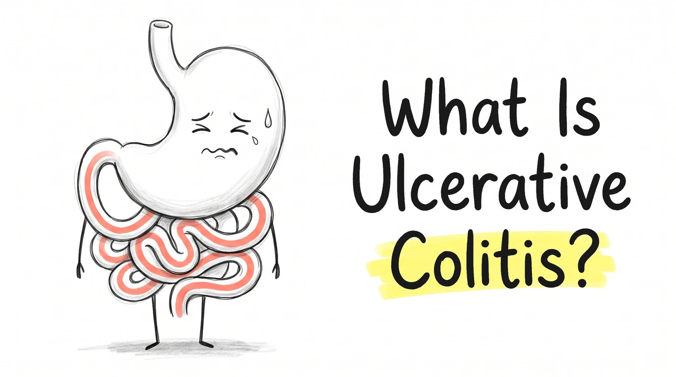 Thumbnail for the Know Your Gut article What Is Ulcerative Colitis? Drawn in the site's hand-drawn cartoon gut-character style.