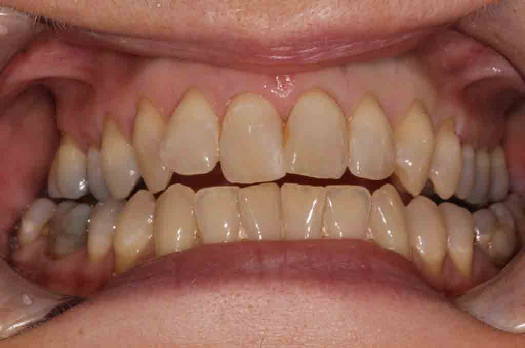 cosmetic-dentist-case-photo-1