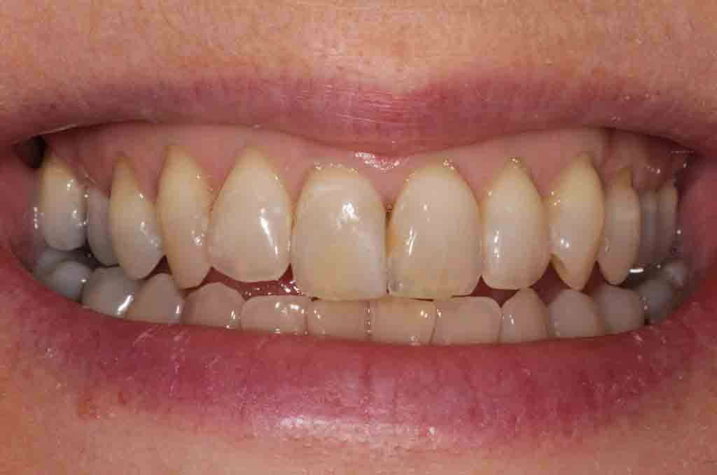 cosmetic-dentist-case-photo-2