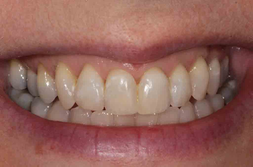 cosmetic-dentist-case-photo-3