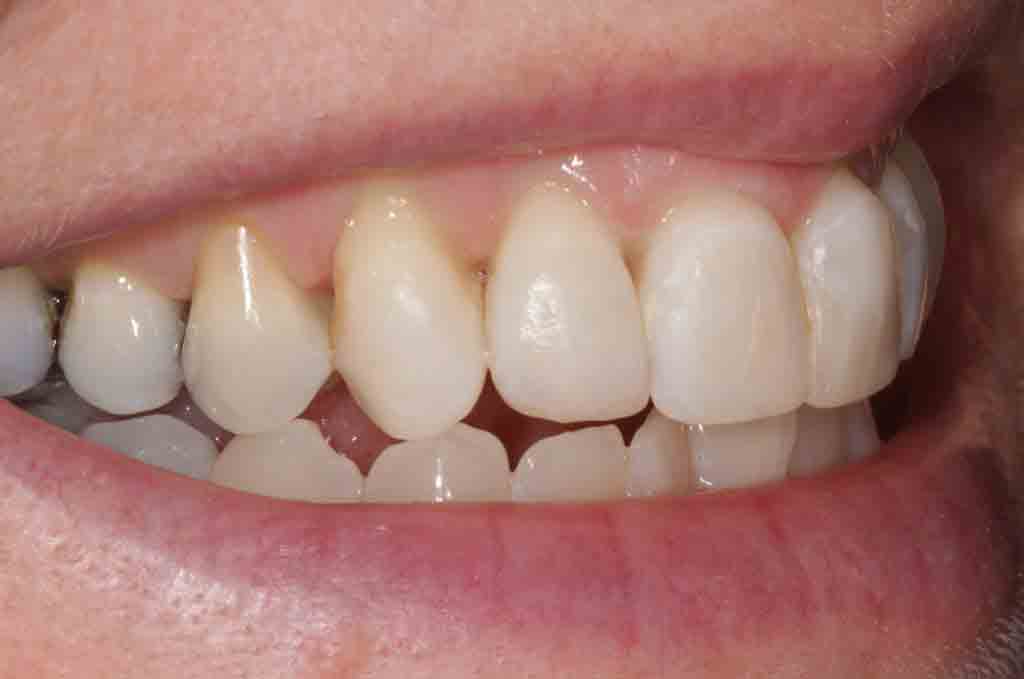 cosmetic-dentist-case-photo-4