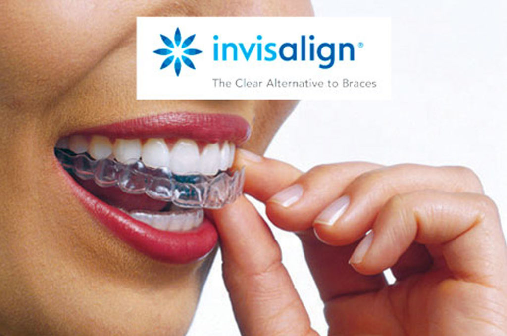 invisalign-clear-braces-in-leeds