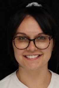 invisalign-and-composite-bonding