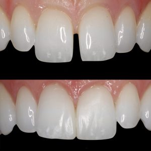 cosmetic-dentistry