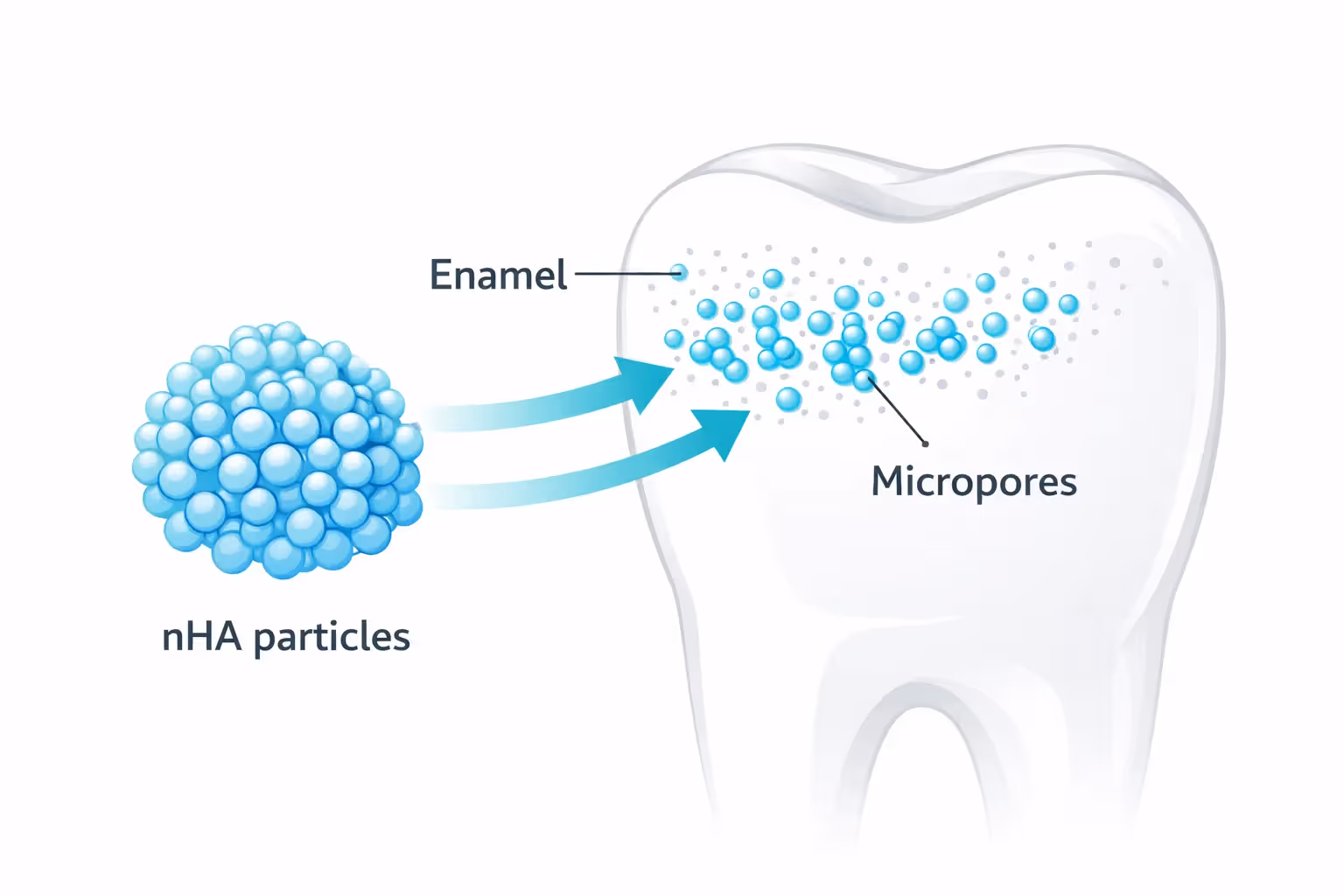 Diagram showing how nano-hydroxyapatite particles repair enamel micropores