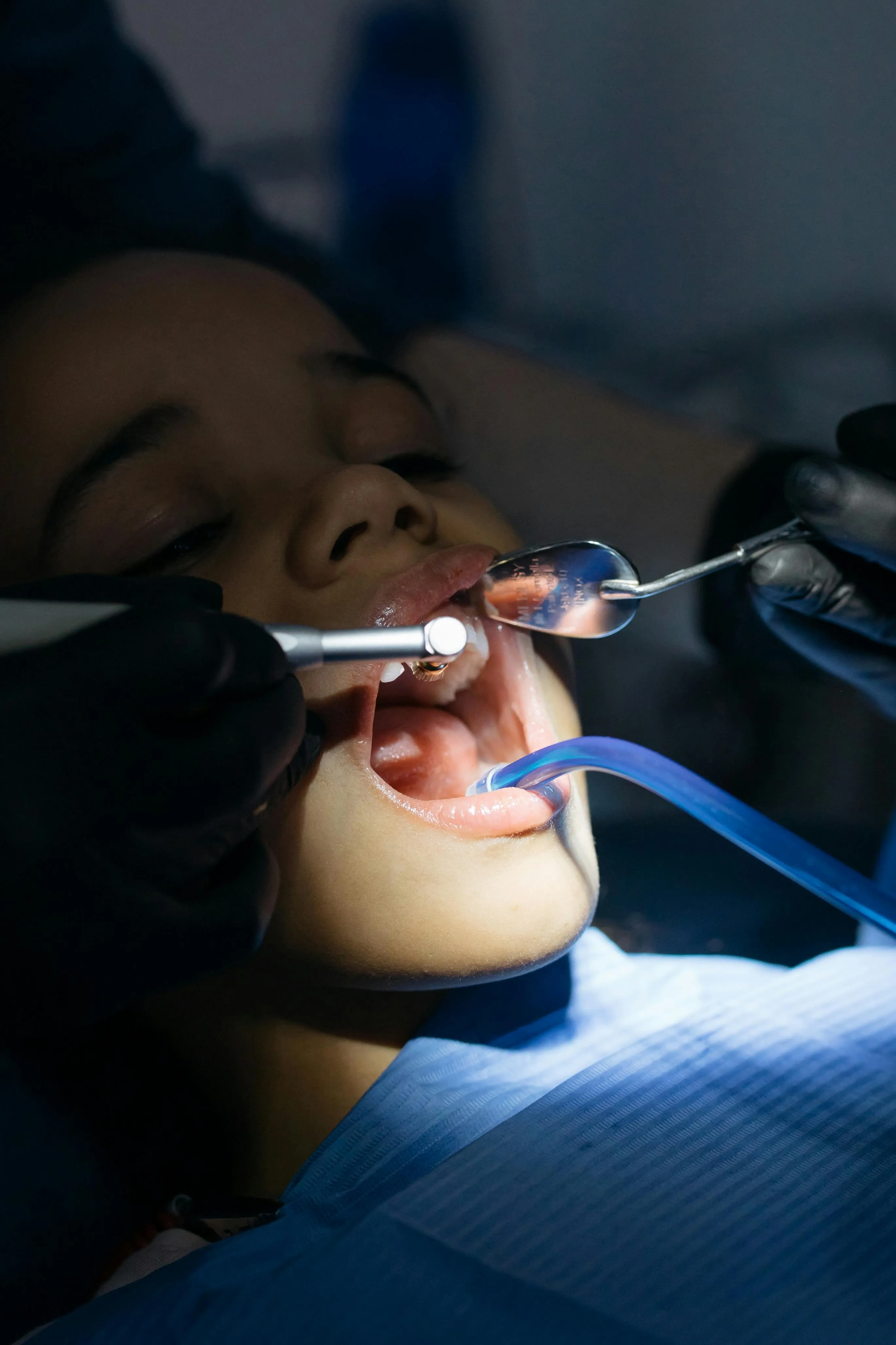 Dental professional applying a fluoride treatment to a child's teeth using a small dental instrument to strengthen enamel