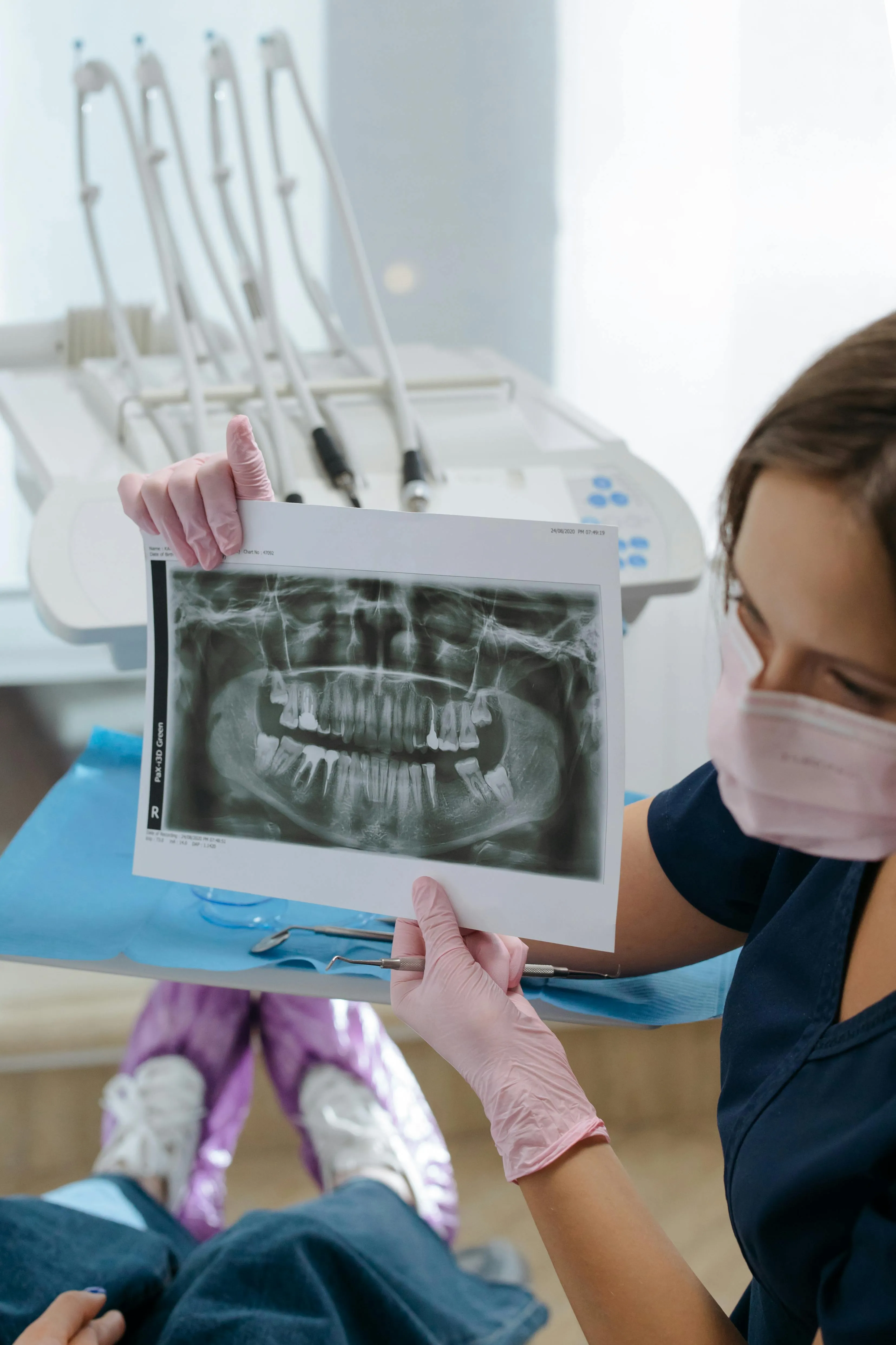 Dental professional reviewing a full-mouth panoramic X-ray to evaluate the extent of infection, root shape, and surrounding bone as part of root canal diagnosis