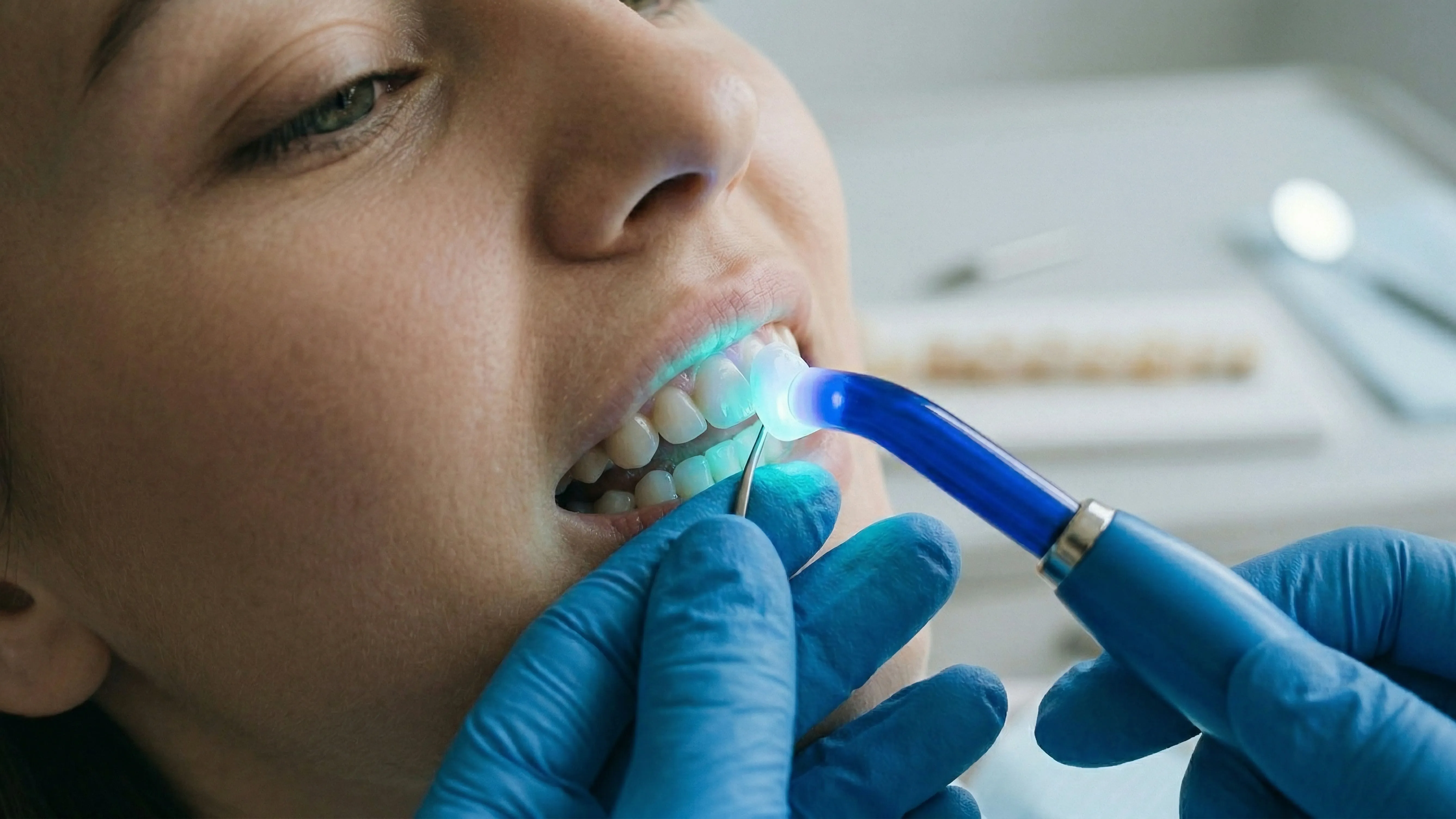 Close-up of composite bonding being applied to a patient's lower teeth with a dental instrument, representing a minimally invasive cosmetic correction