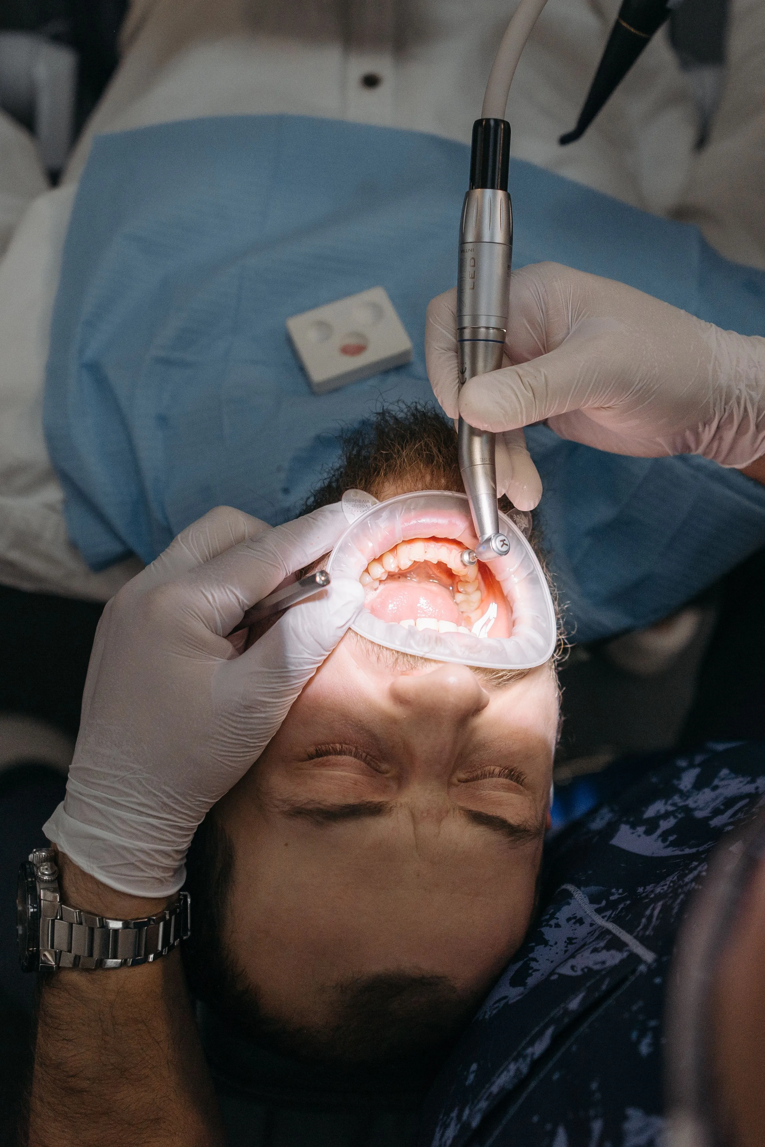 A dentist wearing gloves uses dental tools inside a man's open mouth during treatment.
