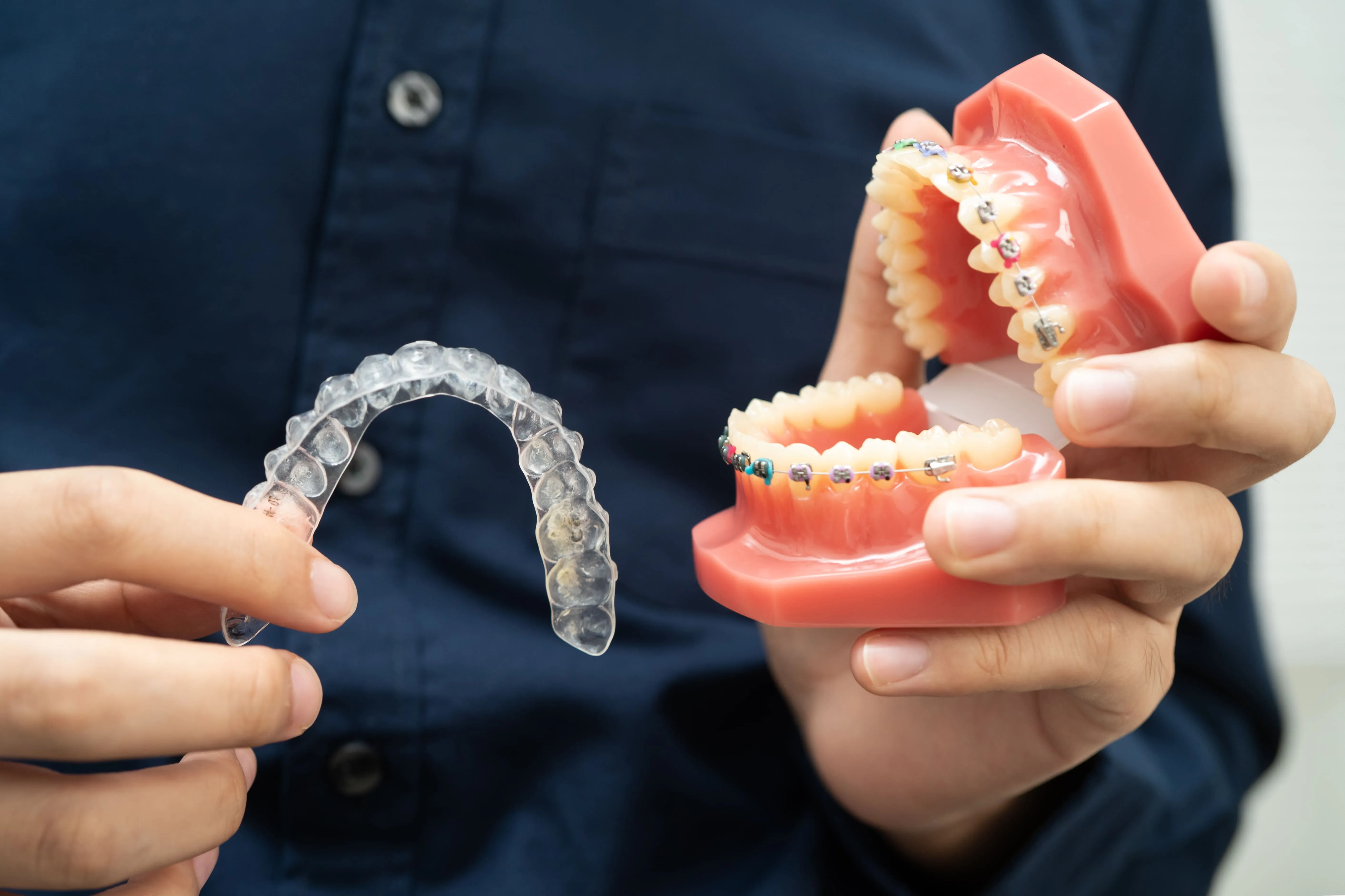 Clear aligner compared with traditional braces on a dental model