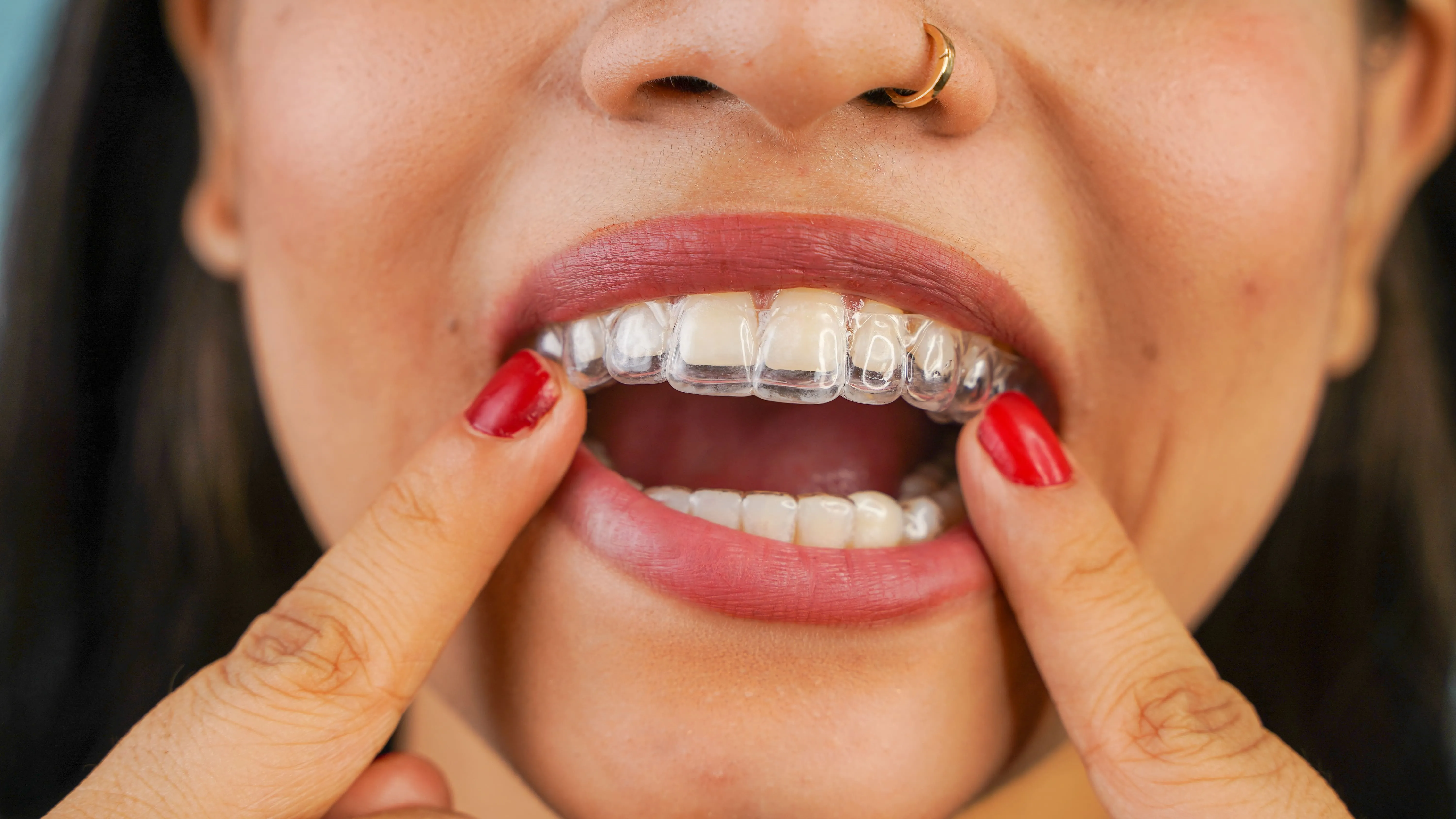 Smiling woman holding a clear Invisalign aligner tray up to her teeth, representing the discreet and comfortable orthodontic treatment available through Invisalign® at Ortega Cottage Dentistry in San Juan Capistrano