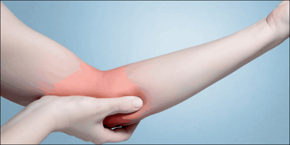 https://esportshealthcare.com/medial-epicondylosis/