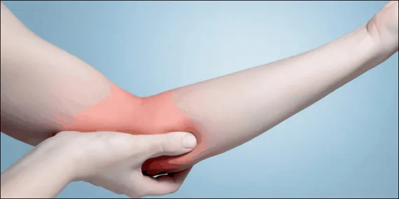 https://esportshealthcare.com/medial-epicondylosis/