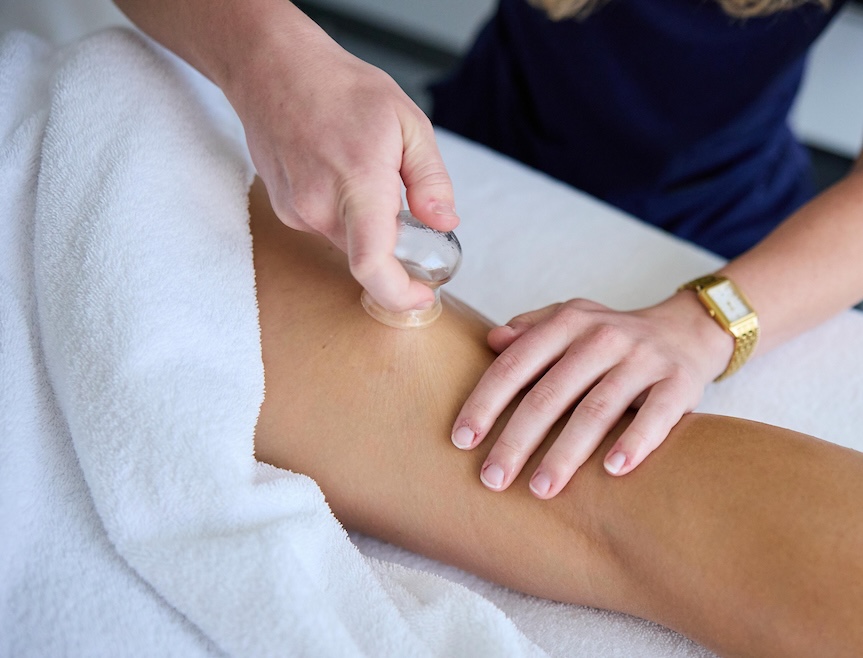 Close-up of a therapist's hands applying a glass suction cup on a person's thigh during a spa treatment, with the person partially covered by a white towel.